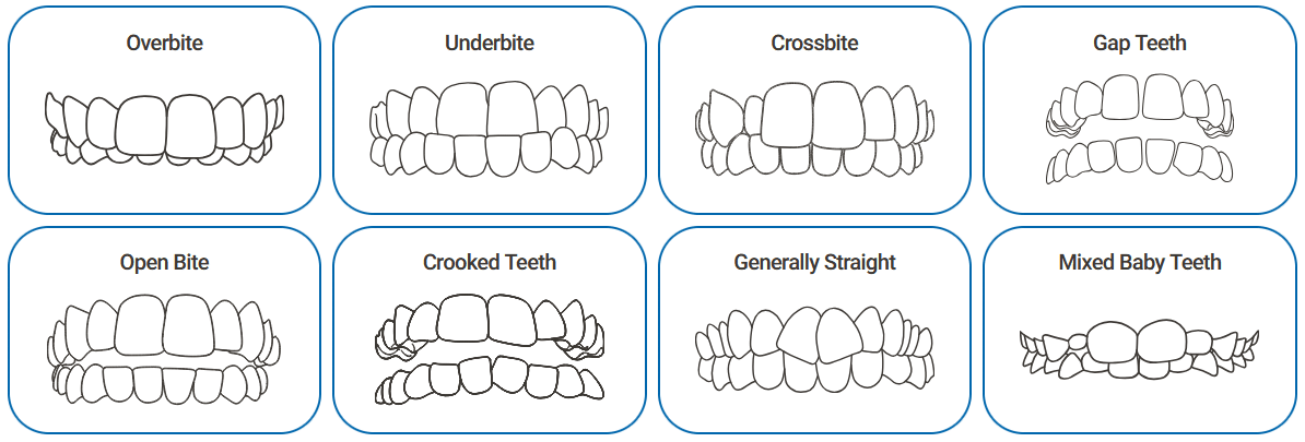 Animated black and white smile chart with eight images depicting different types of tooth alignment.